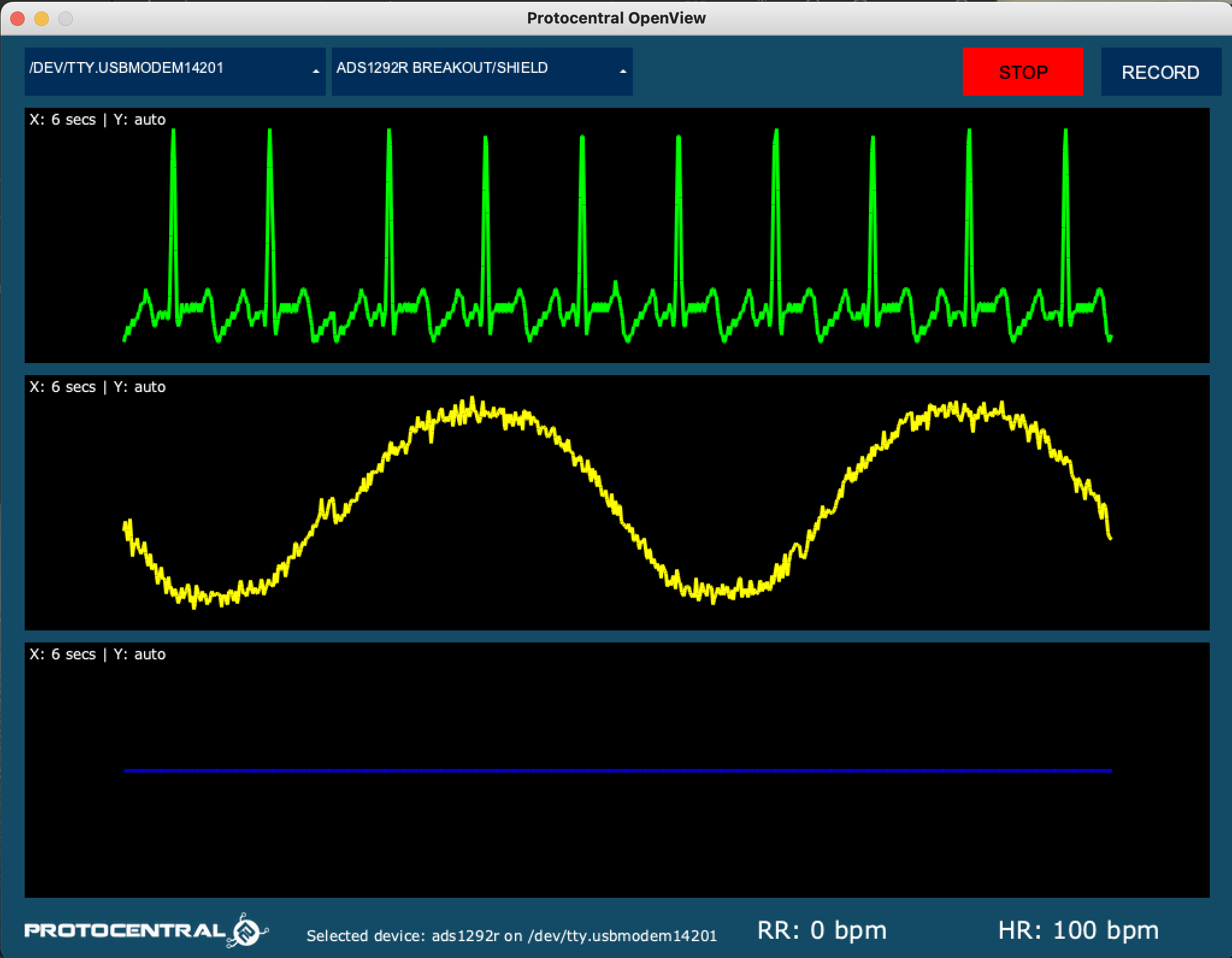 streaming vitals