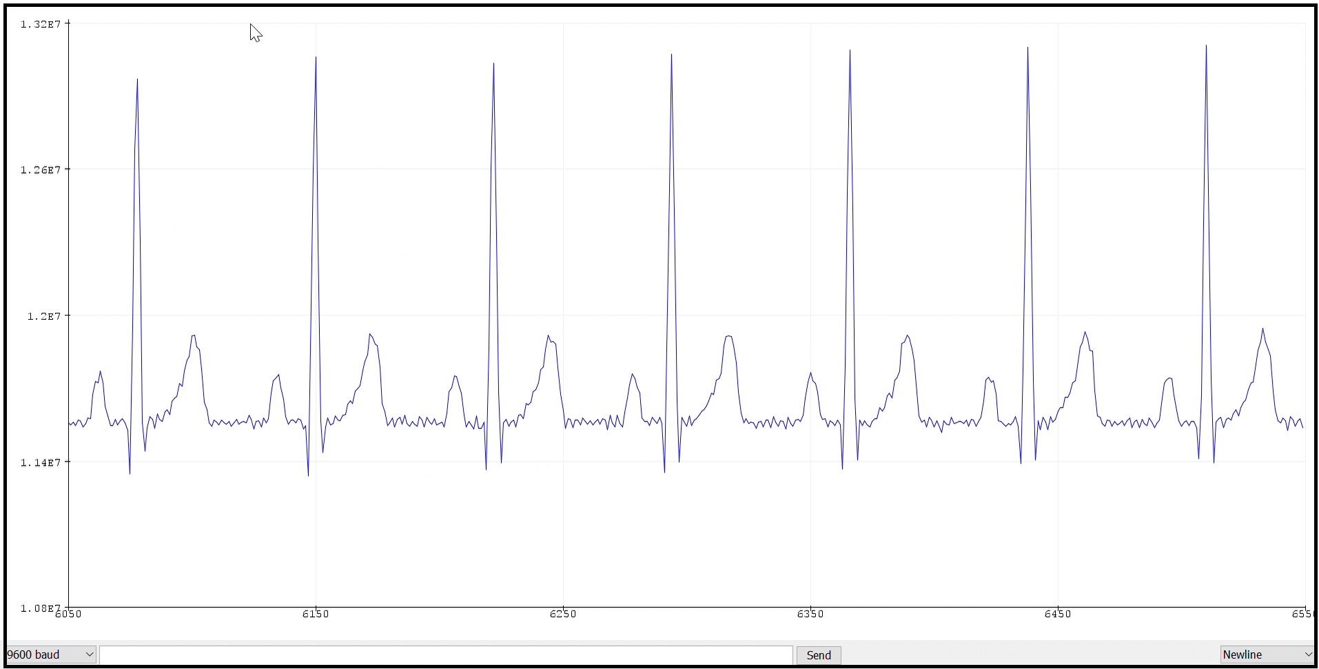 ECG streaming