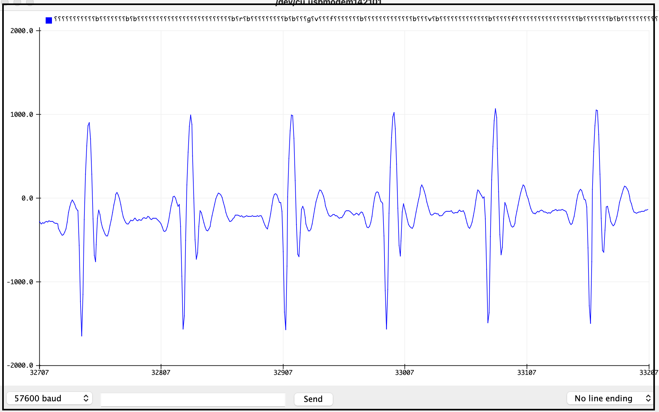 ECG streaming